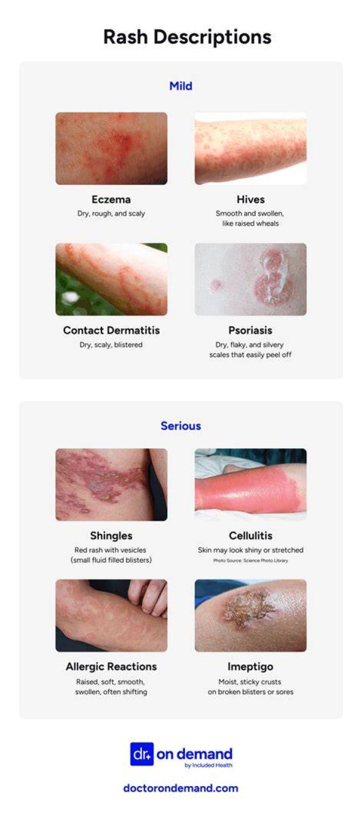 Can Diuretics cause skin rash?