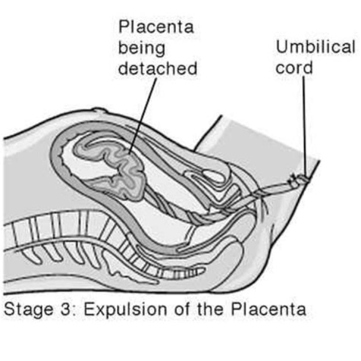Do you have to have an injection to deliver the placenta?