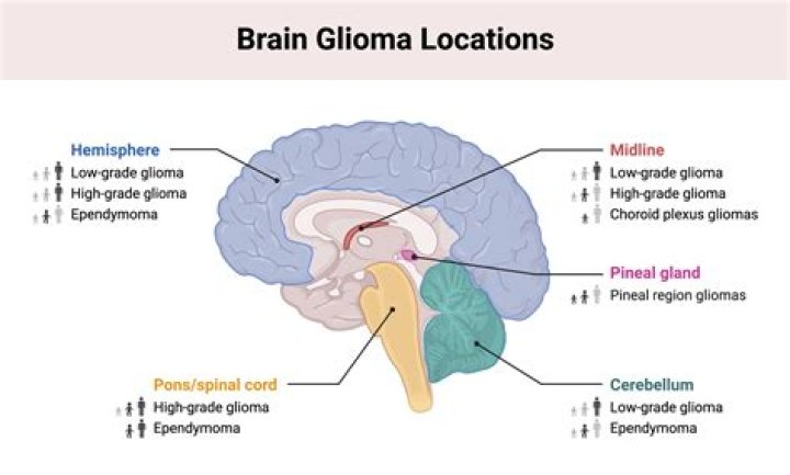 How common are trigeminal schwannomas?
