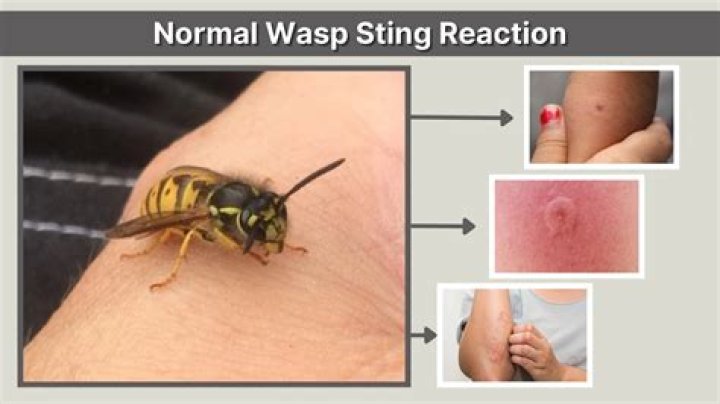 Is it normal for a wasp sting to itch a week later?