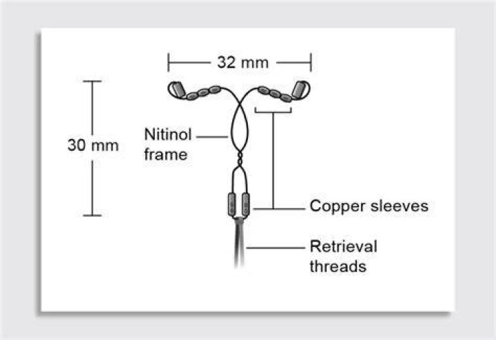Is there a hormone free IUD?