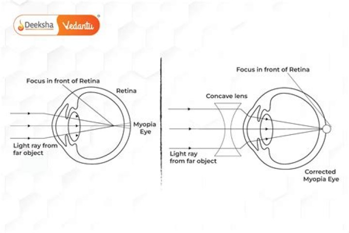 What are eye defects and their correction?
