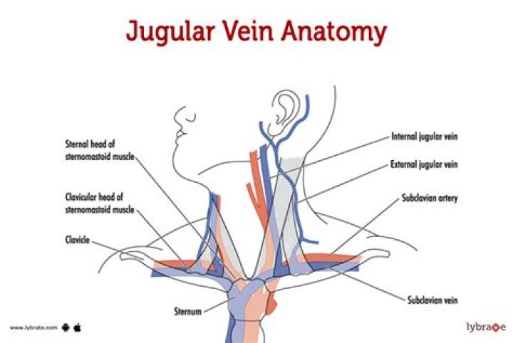 What can cause jugular vein engorgement?
