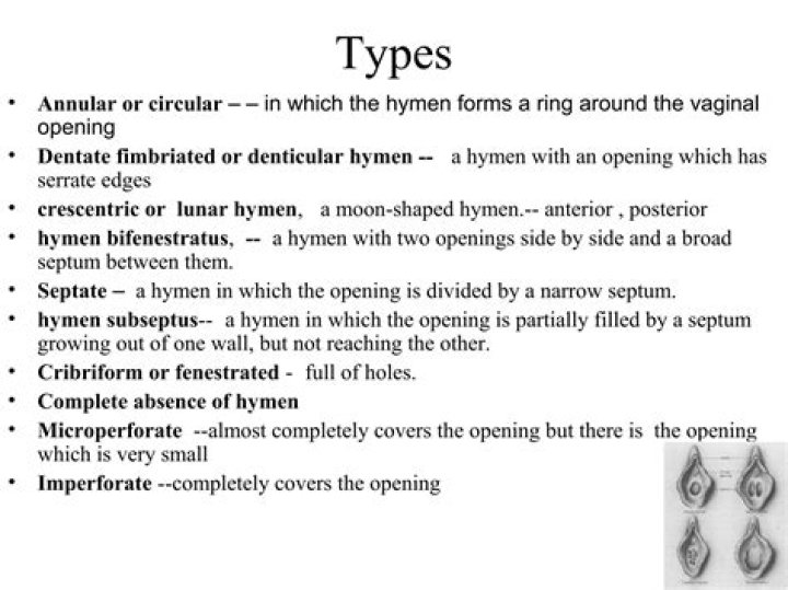 What causes a tight Hymenal ring?