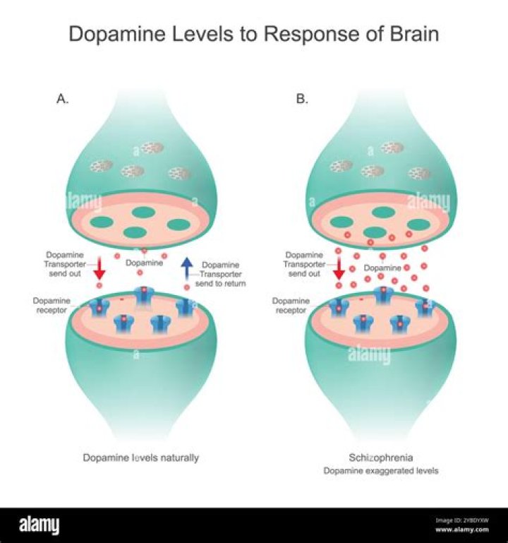 What causes high levels of dopamine in the brain?