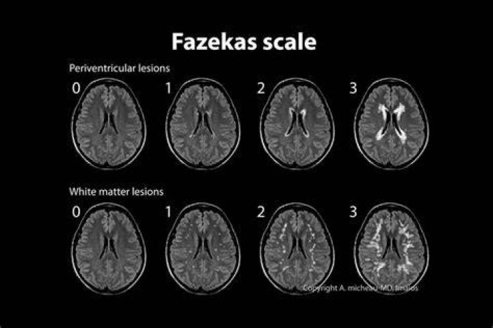 What does Satropy mean?