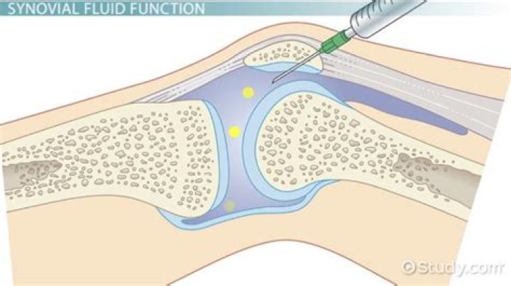 What does turbid synovial fluid mean?