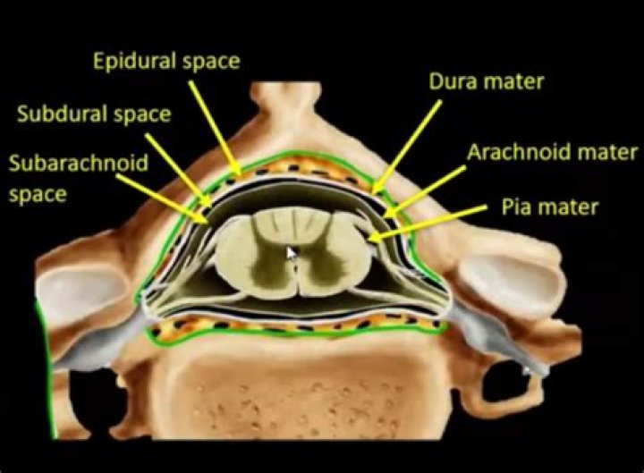 What is in the subdural space in the spinal cord?