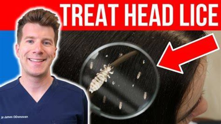 What treatment kills nits?