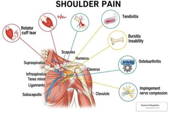 When should I worry about shoulder pain?